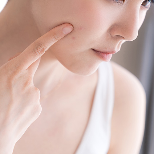 韓国ソウルプレミアム皮膚科オガナセルのにきびの管理システムです。 大人＆再発性によるニキビ・傷跡治療をご希望の方におすすめ！